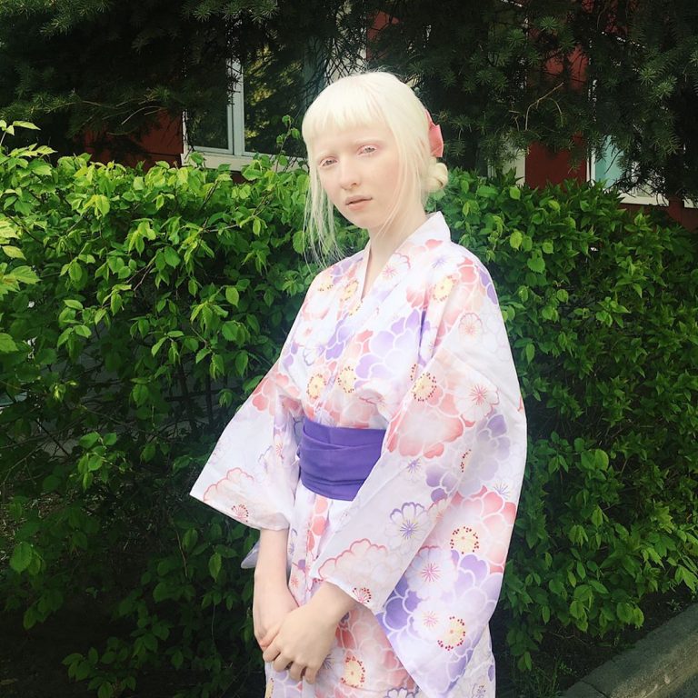 アルビノの芸能人とモデル22人！日本人の割合も解説【メラニン色素がない】